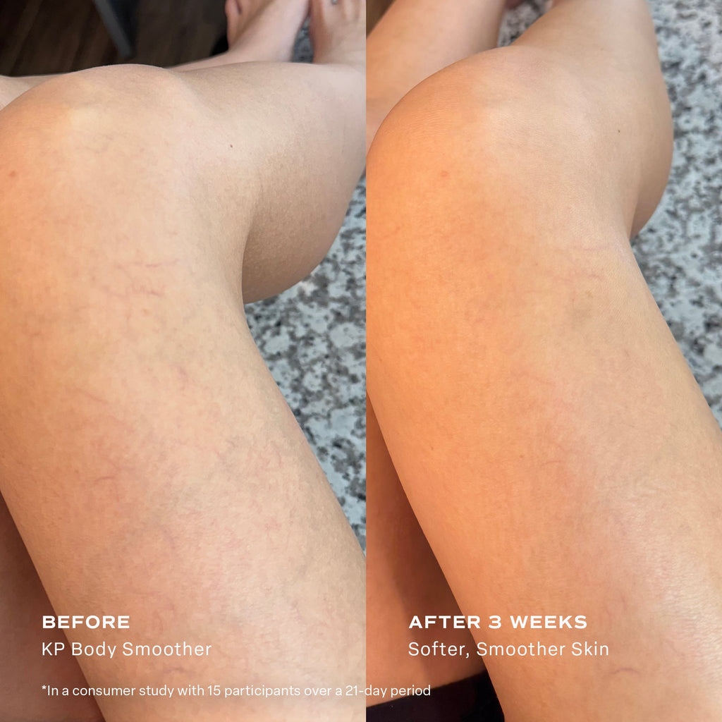 KP Body Smoother Exfoliating Milk