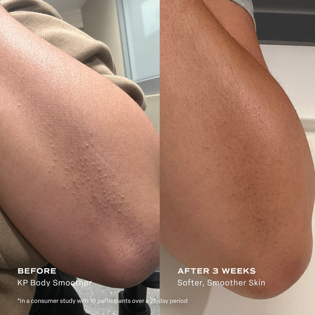 KP Body Smoother Exfoliating Milk